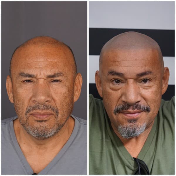 Full scalp SMP before and after result 1 at Union Barber SMP Torrance